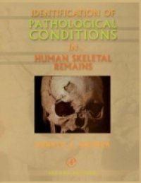 Читать Identification of Pathological Conditions in Human Skeletal Remains