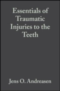 Читать Essentials of Traumatic Injuries to the Teeth