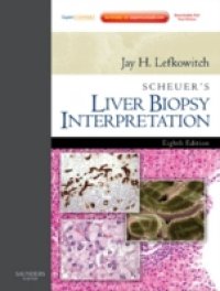 Scheuer`s Liver Biopsy Interpretation