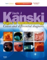 Signs in Ophthalmology: Causes and Differential Diagnosis