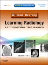 Читать Learning Radiology: Recognizing the Basics