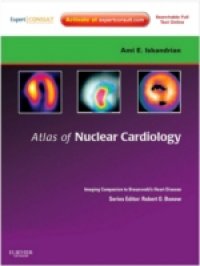Atlas of Nuclear Cardiology: Imaging Companion to Braunwald`s Heart Disease