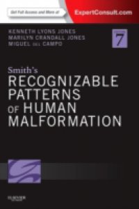 Smith`s Recognizable Patterns of Human Malformation