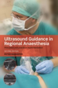 Ultrasound Guidance in Regional Anaesthesia: Principles and practical implementation