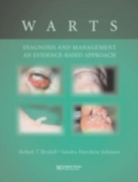 Warts