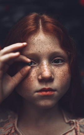 Все беды от веснушек!